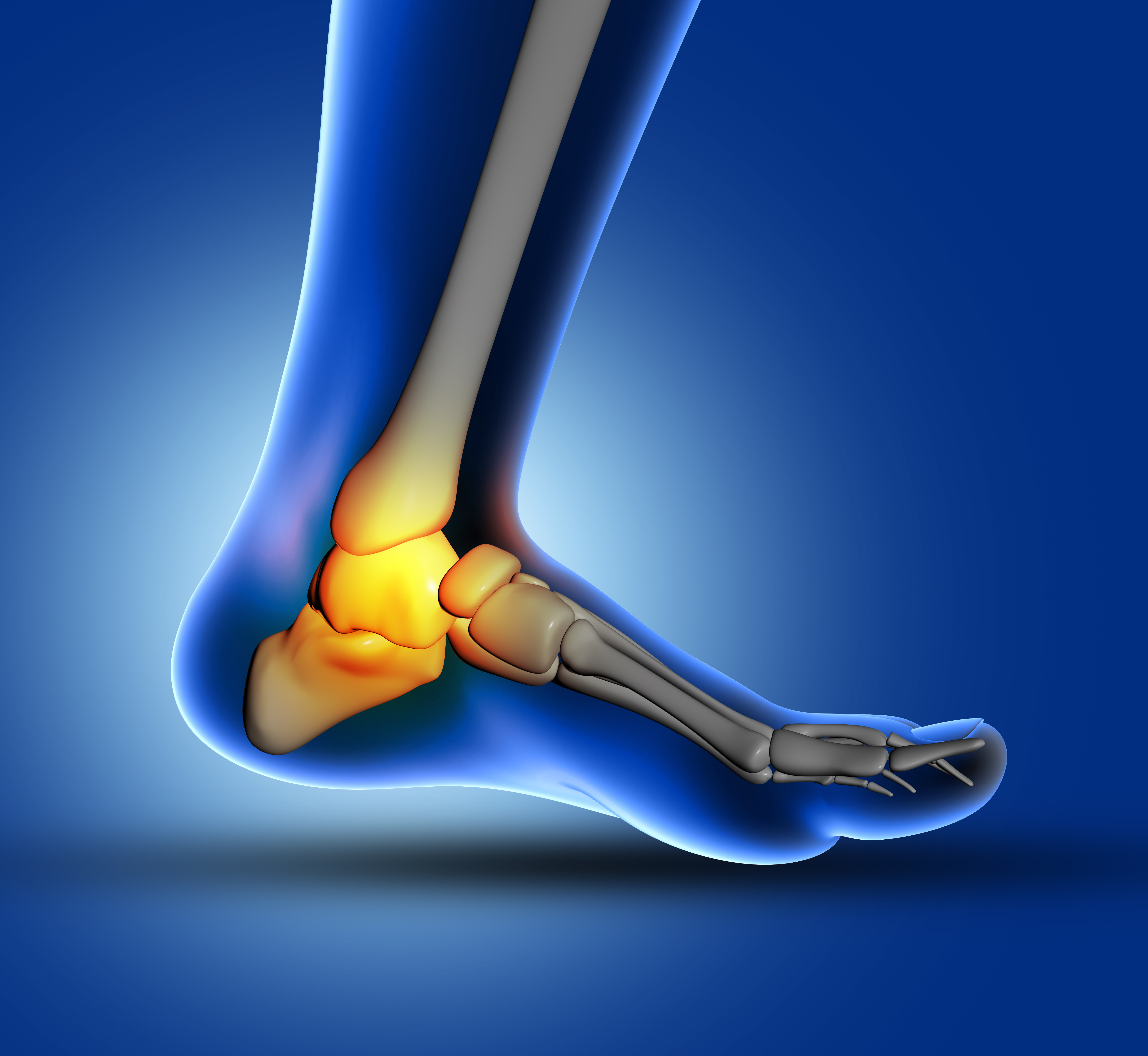 Gout