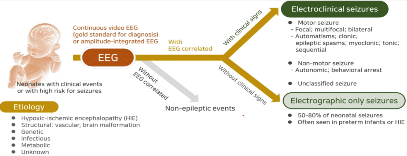 EEG Approach